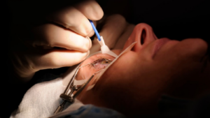 Read more about the article The Recovery Time For Lasik Surgery